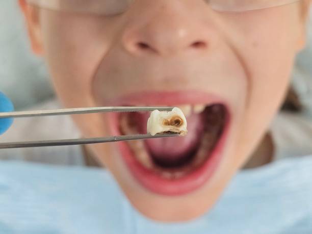 Best Pediatric Emergency Dentist in Trenton, TN